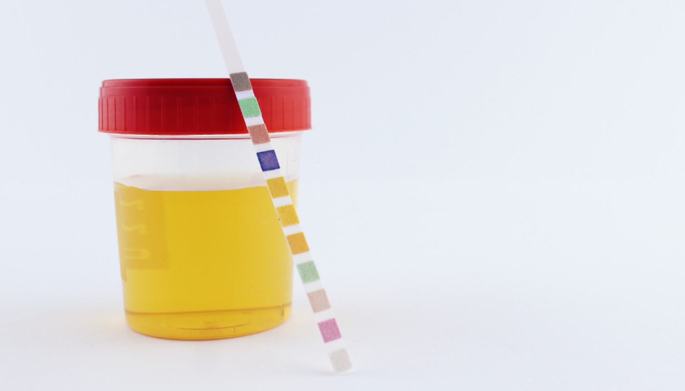 Bandelette test urine : un outil simple pour surveiller sa santé à domicile